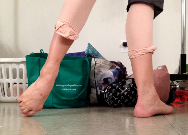 Mundo Bailarinístico - Blog de Ballet: Dança e Saúde - Pé de Bailarina -  Joanetes