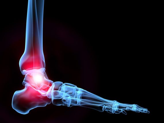 Chronic Ankle Pain - Anatomy Diagram - Lisa Howell - The Ballet Blog