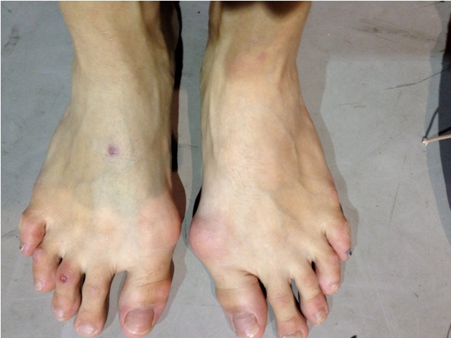 pointe dancers feet