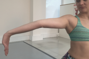 What is hypermobility? What is hypermobility?